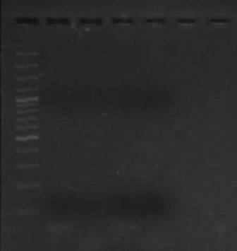Figure 1: showing HPV 16/18 DNA positivity in mother and neonate after UV exposure of eectrophoresed gel 