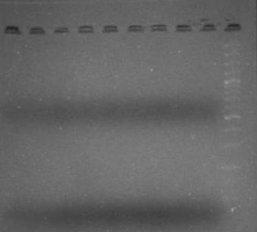 Figure 2: showing HPV 16/18 negativity in neonates of HPV positive mothers(not shown in the figure).