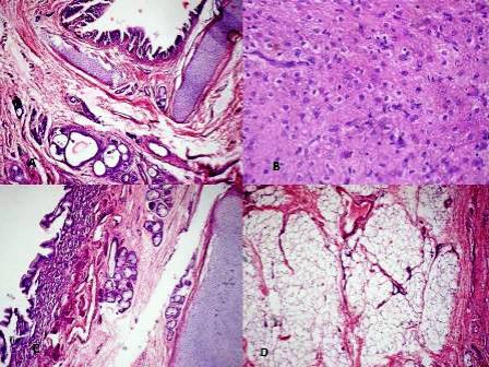 Figure 2: Photomicrograph showing A) Immature cartilage, respiratory epithelium and glandular epithelium. B) Neuroglial tissue C) Immature cartilage, Gastric mucosa and mucus glands. D) Lobules of adipose tissue.