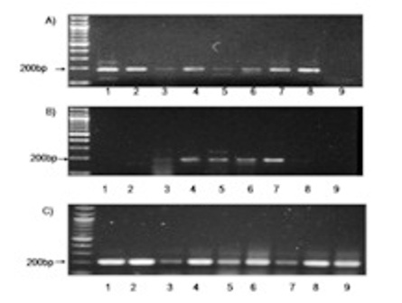 Figure 1: RT PCR analysis of messenger RNA (mRNA) using primers specific for A) survivin in breast cancer cases (1-9) B) survivin in fibroadenoma cases(1-9) C) Amplification of GAPDH was serially analysed for all samples. 