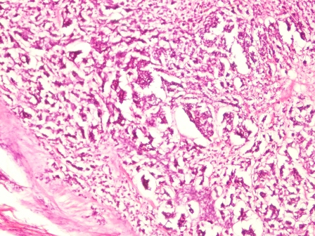 Figure 2- Microphotograph of the stained slide