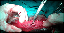broken penis repair Naked aussie boys