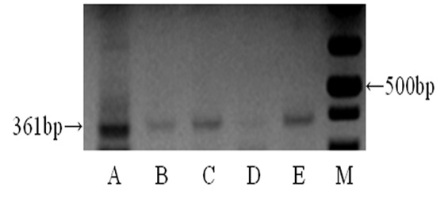 Figure 3: RT-PCT for human MISRII from human female genital tract. Bands of 361 bp are detected very strongly in ovary (A), and moderately detected in uterine cervix (B), uterine endometrium (C), and uterine tube (E). But from uterine myometrium (D) bands of 361 bp is mildly detected. 